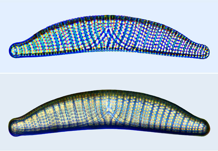 Epithemia turgida