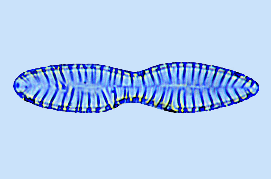 Surirella linearis var. constricta