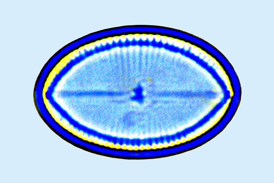 Cocconeis placentula