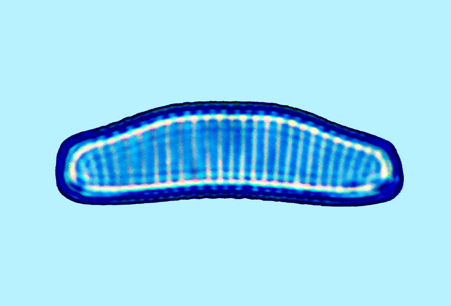 eaudouce eunotia pectinalis