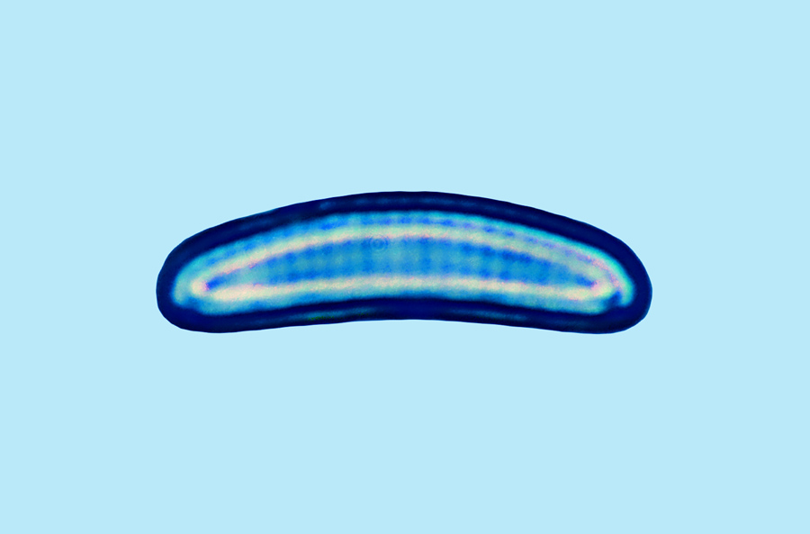 eaudouce Eunotia tenella