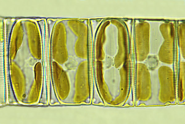 eunotia pectinalis