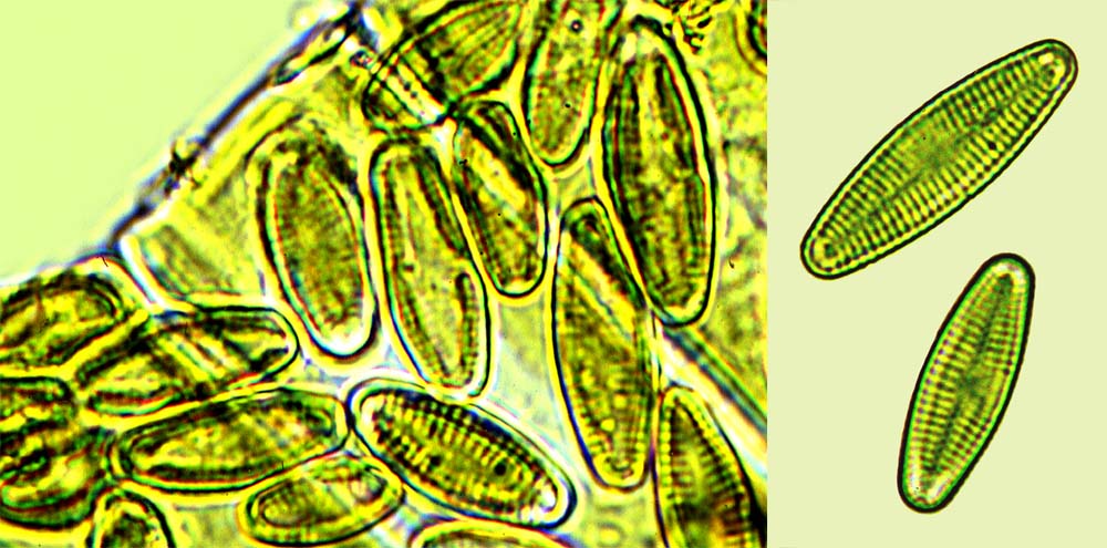 Achnanthidium