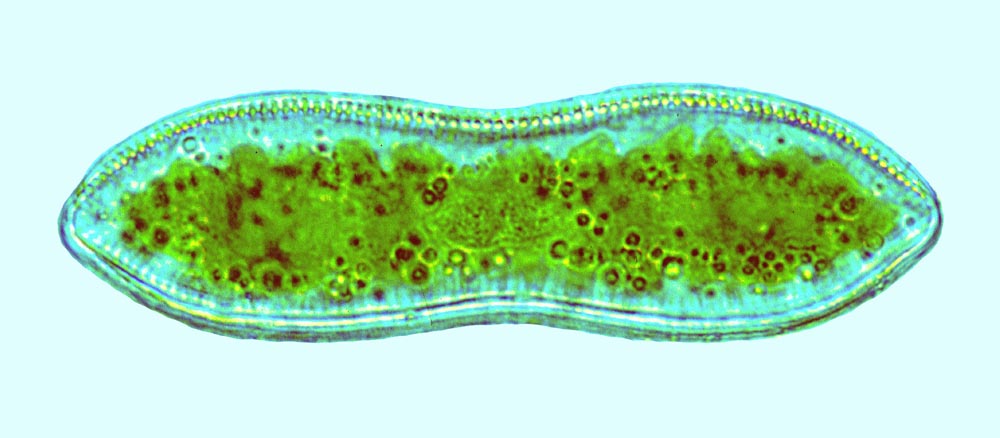 Cymatopleura