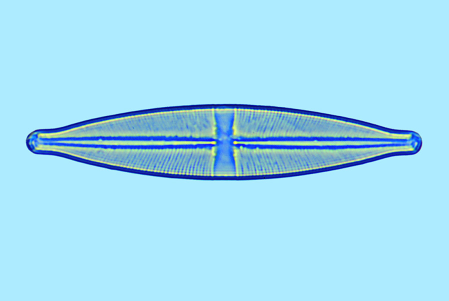 stauroneis phenicenteron