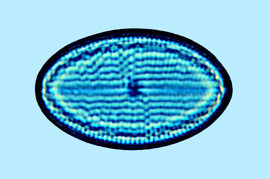 Cocconeis placentulka