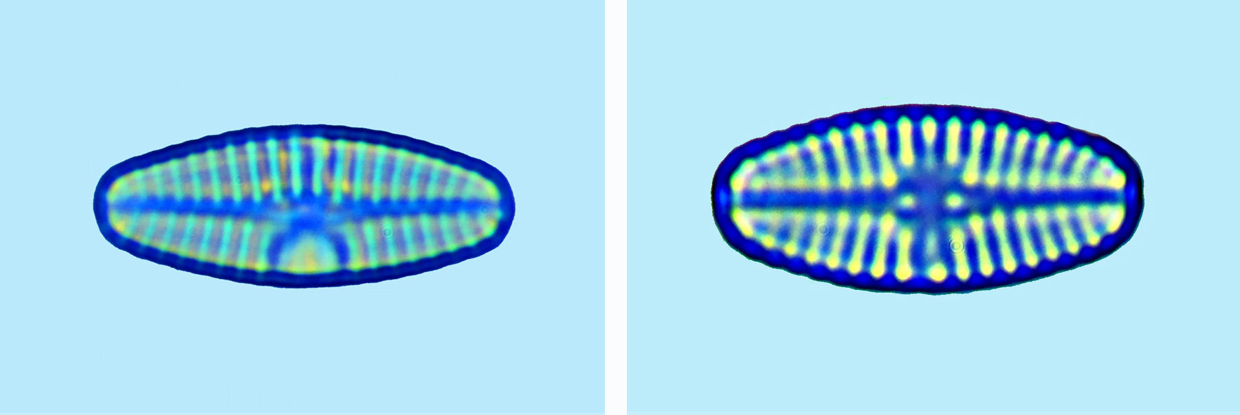 Planothidium