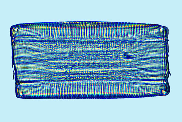 eunotia pectnalisi