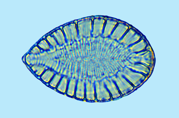 surirella ovalis