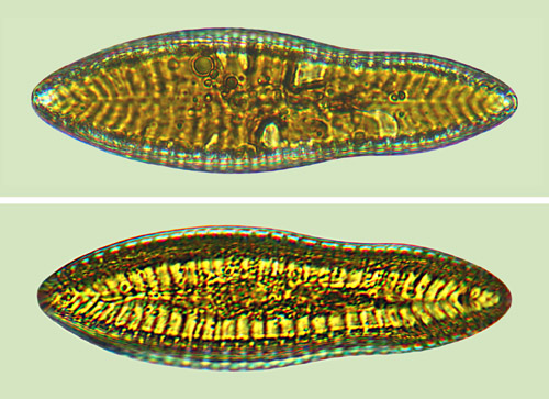 surirella celtica