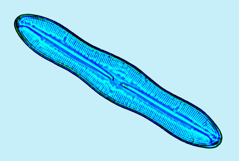 caloneis ventricosa
