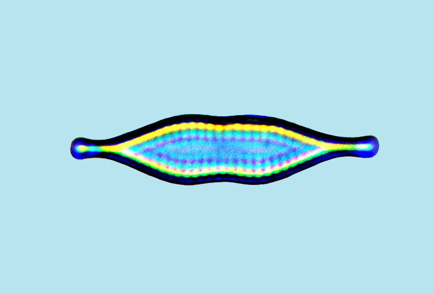 eaudouce synedra parasitica