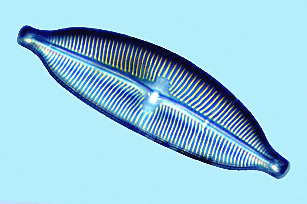 Cymbella heteropleura