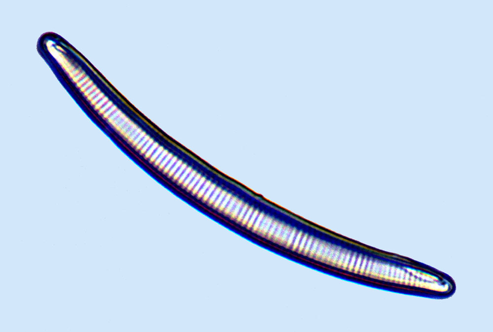 eaudouce Eunotia tenella