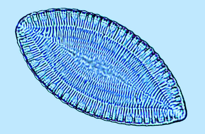 surirella ovalis