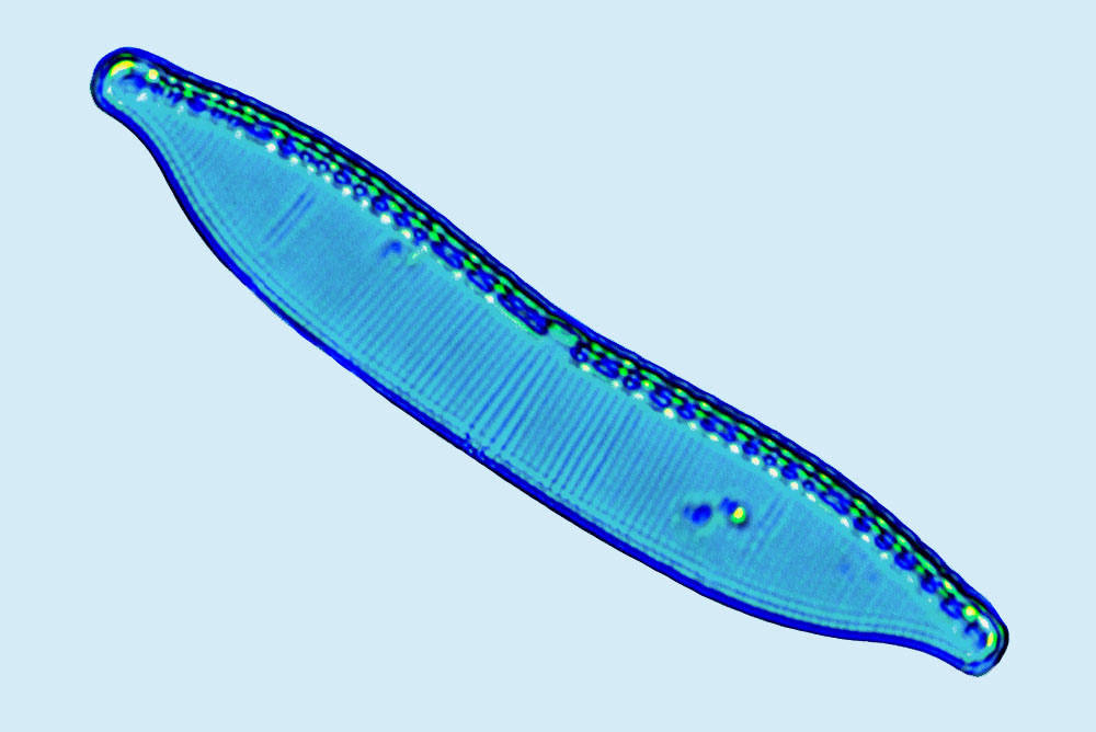 hantzschia amphioxys