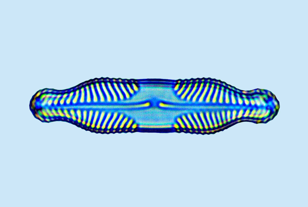 pinnularia mesolepta