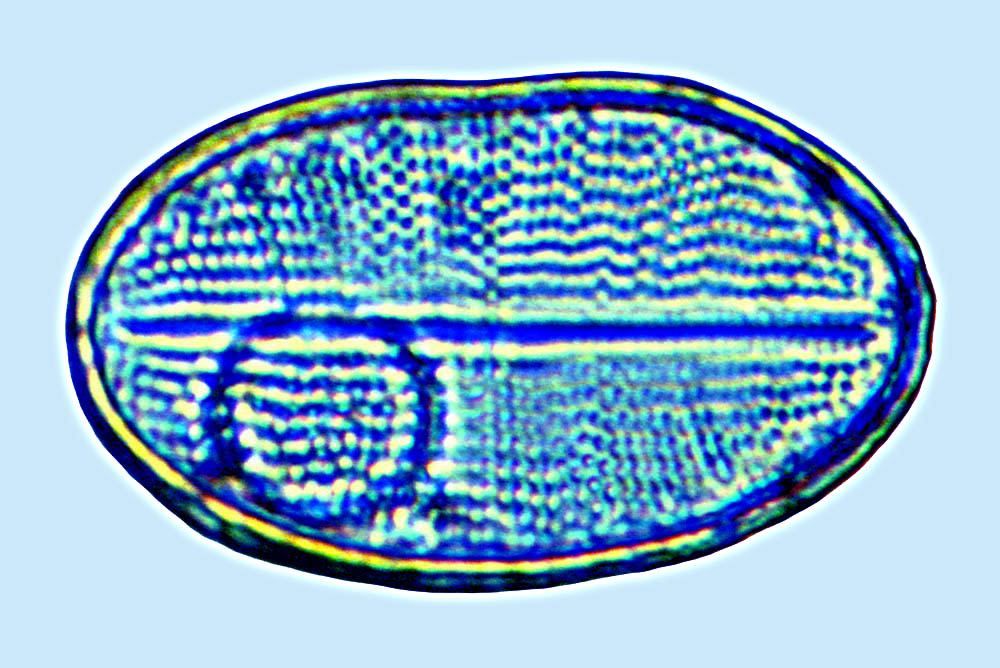 Cocconeis placentula