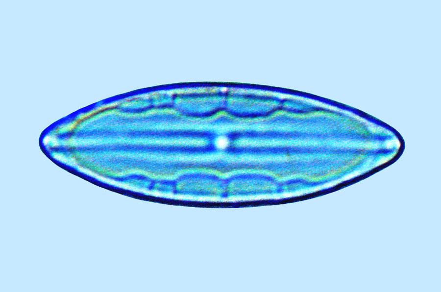 Lyrella Mastogloia exigua