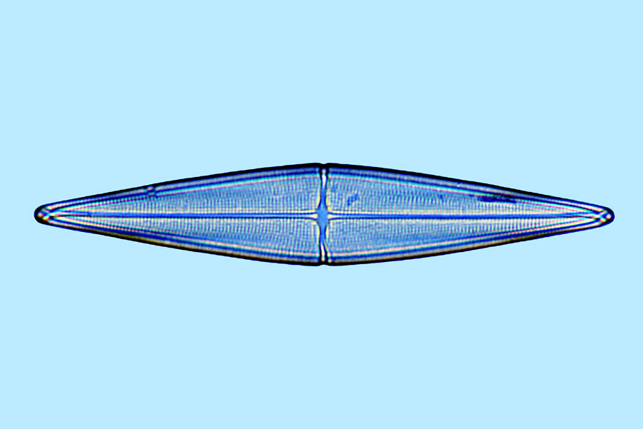 Raphoneis Stauroneis salina