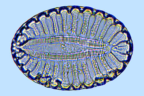 Raphoneis Surirella comis