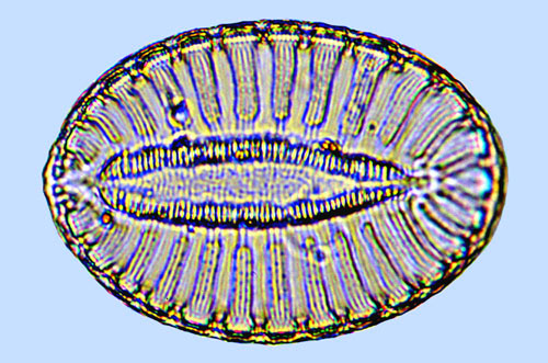 Surirella comis