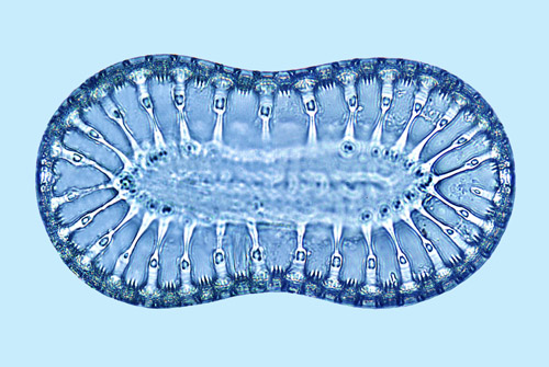 Raphoneis Surirella lata
