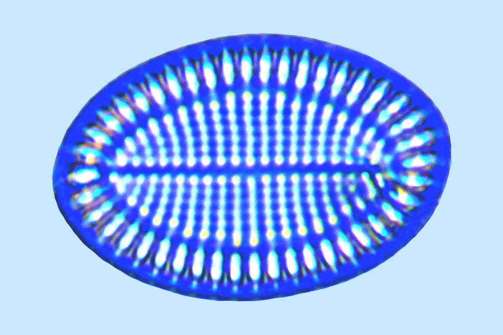 Cocconeis sp