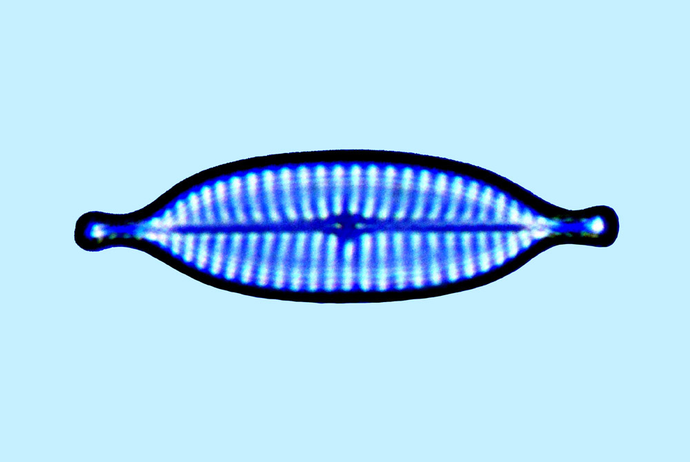 Diamagal navicula uniseriata