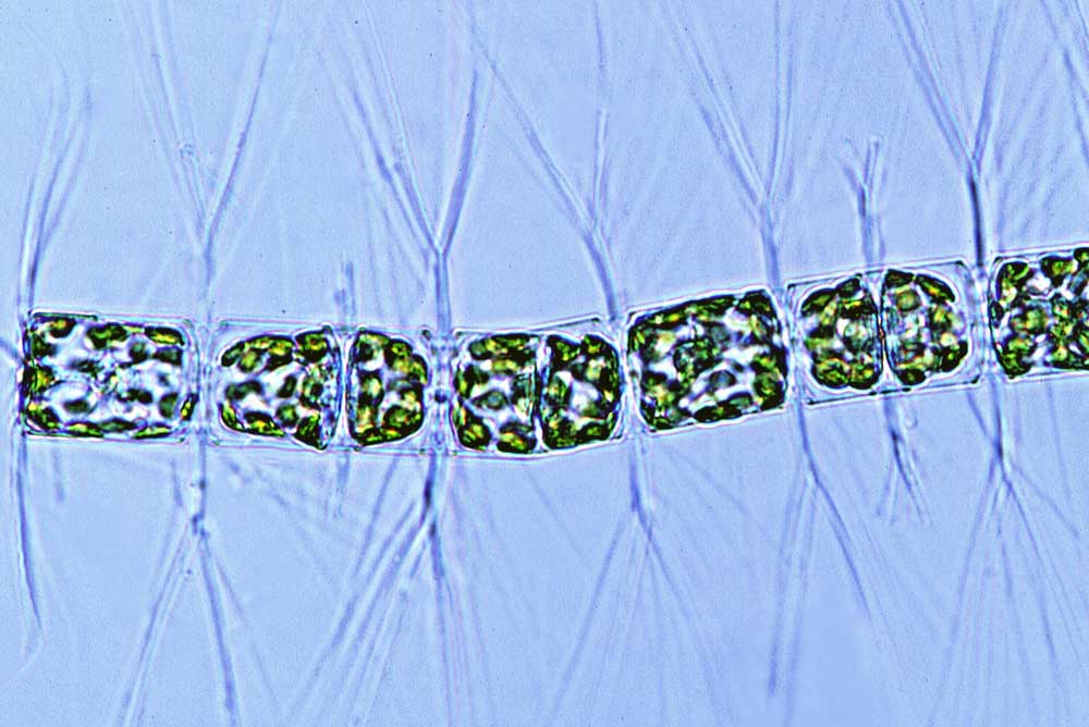 Bacteriastrum