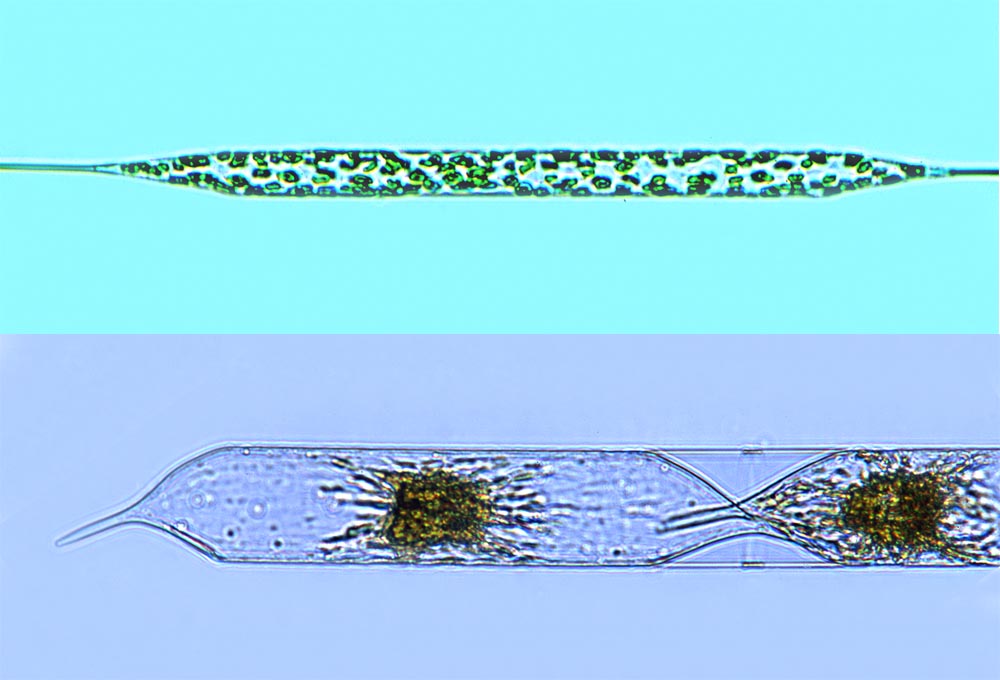 Rhizosolenia