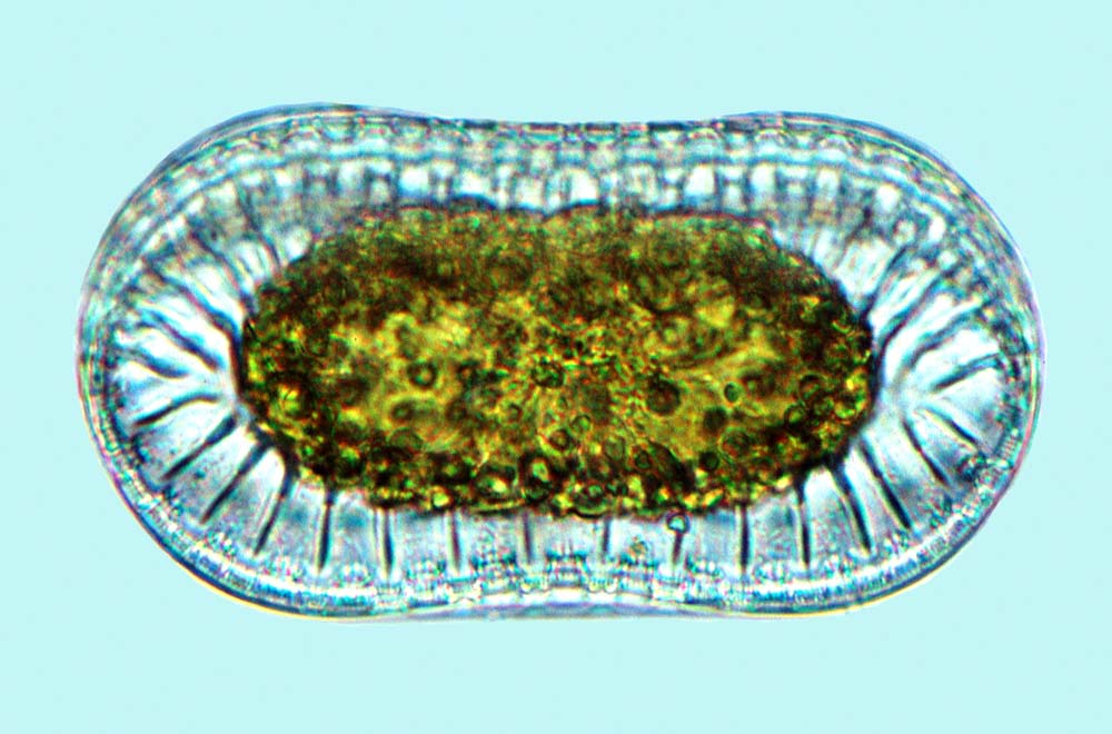 Surirella lata