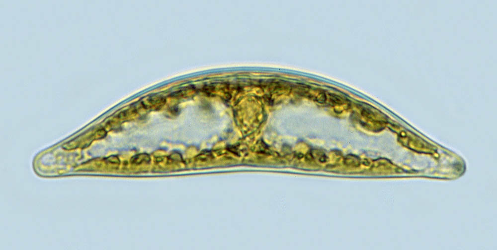 Toxonidea