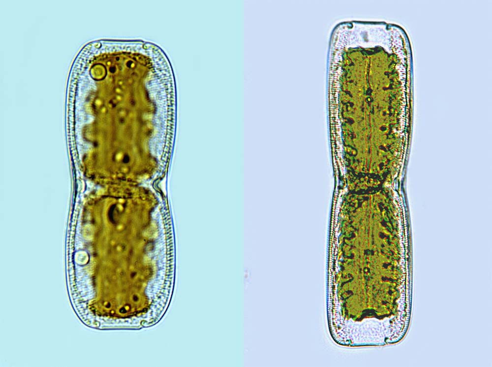 Trachyneis