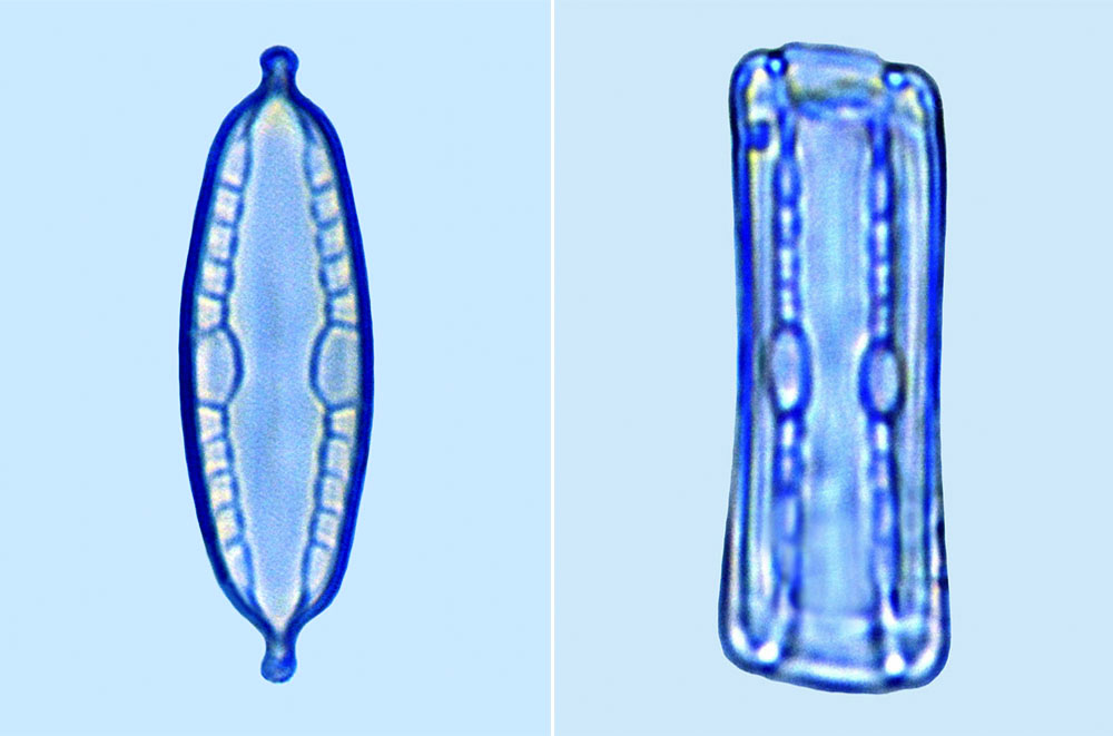 Mastgloia biocellata