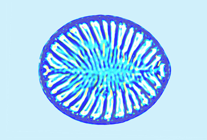 Saumatdeux Surirella brebissonii