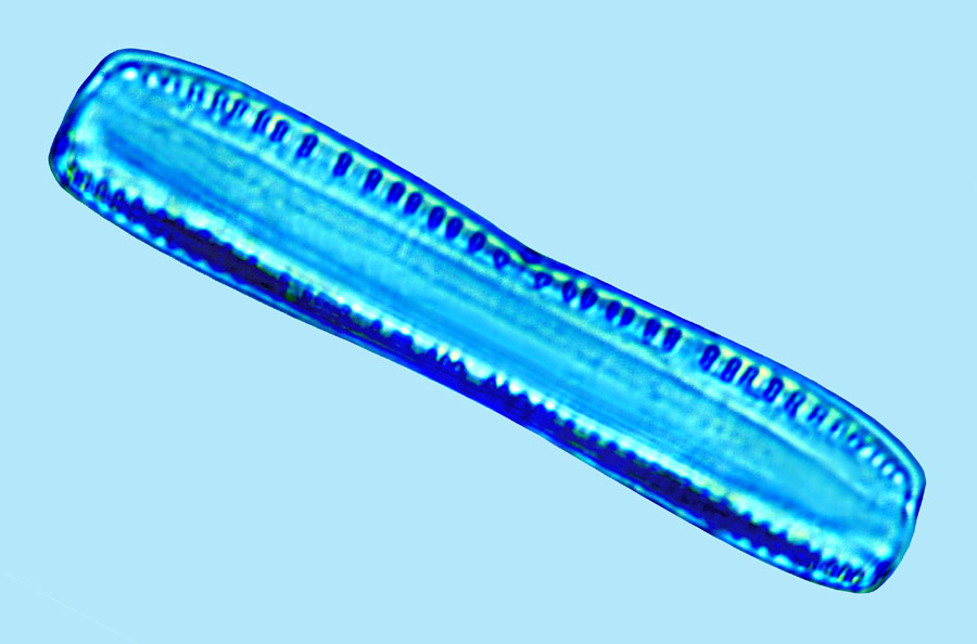 Saumatdeux Nitzschia dissipatoides