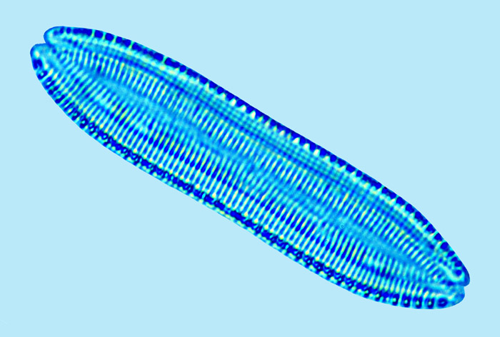 Nitzschia hungarica