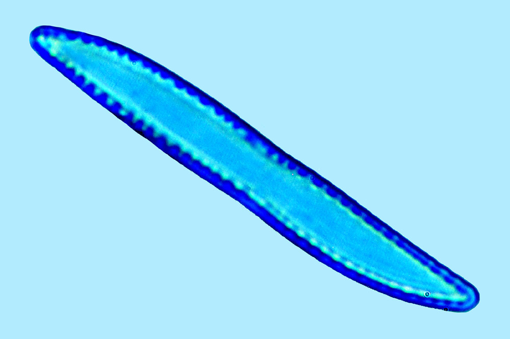 Saumatdeux Nitzschia parvuloides