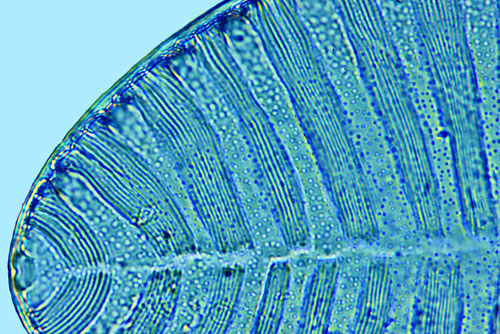 Saumatdeux Surirella striatula