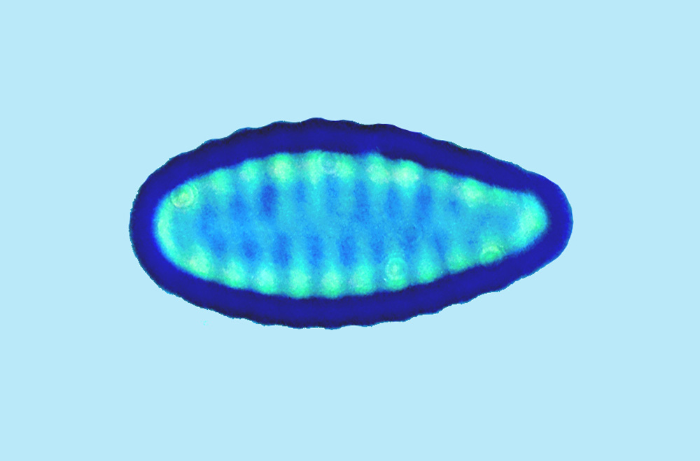 saumatdeux Pseudostaurosira perminuta