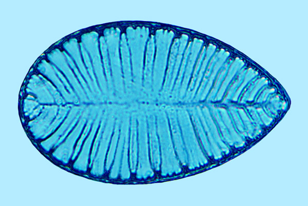 Saumatdeux Surirella striatula
