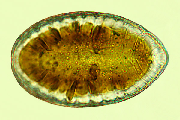 Saumatdeux Surirella striatula