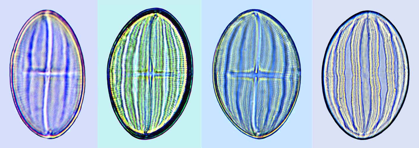 Cocconeis heteroidea