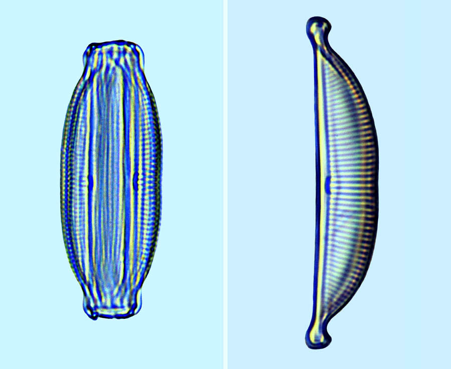 Amphora coffeaeformis