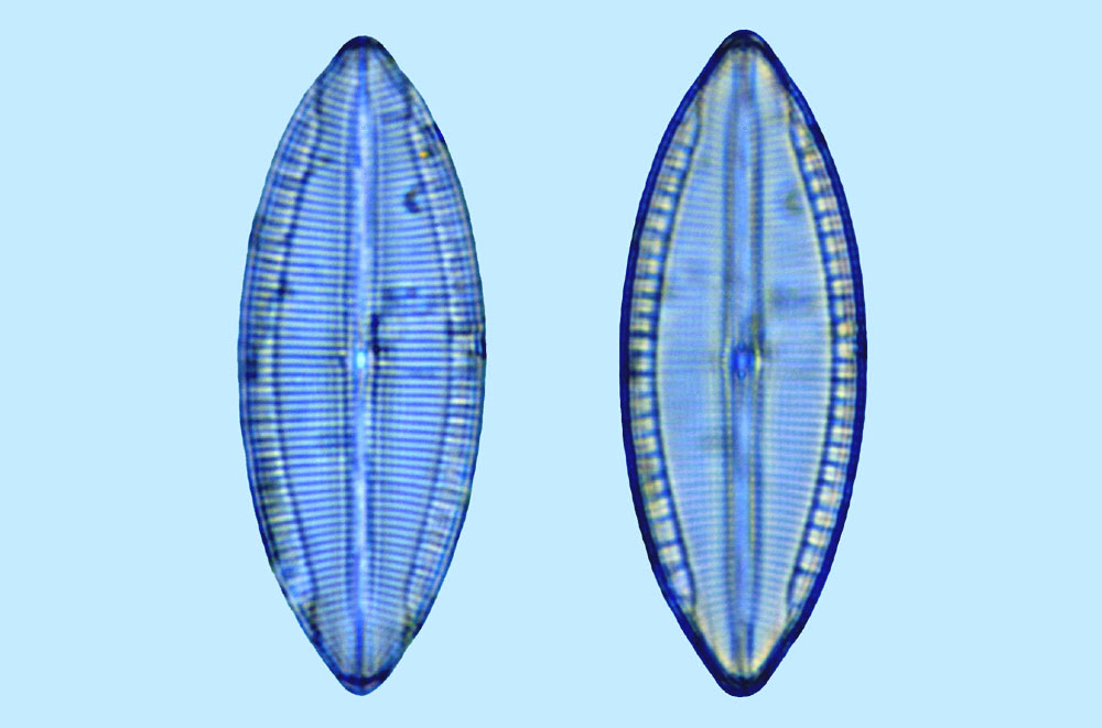 mastogloia acutiuscula