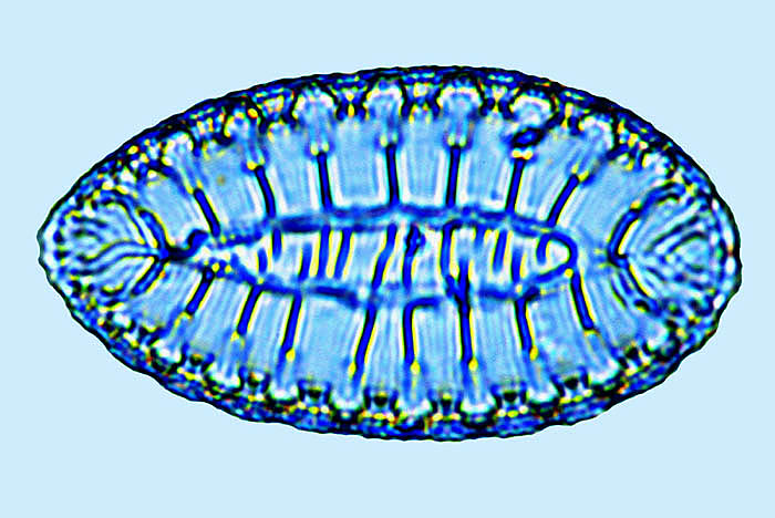 Surirella fastuosa