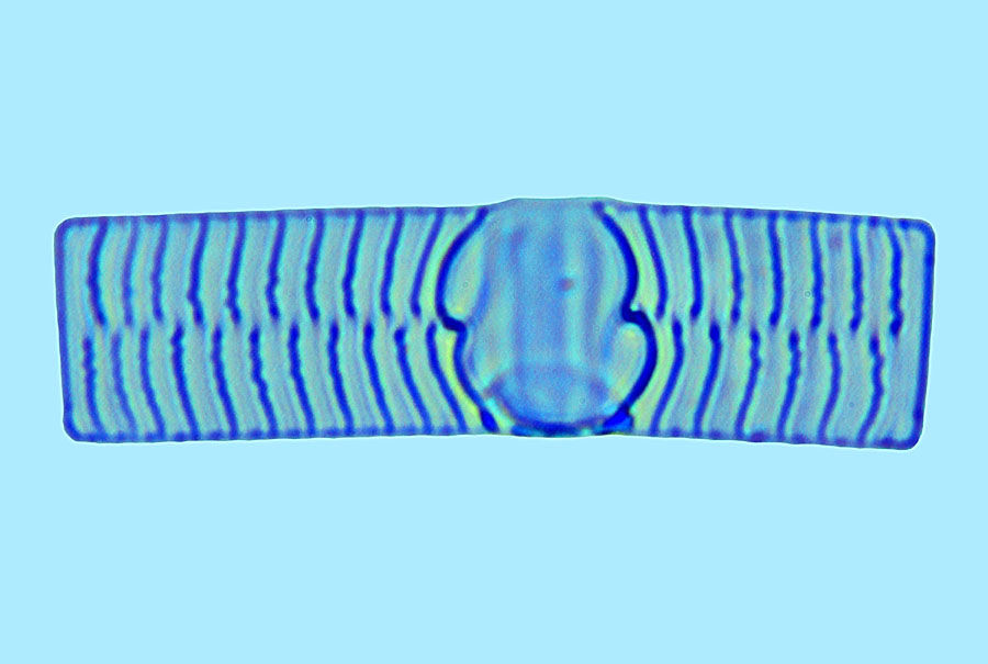 Hyalosira interrupta