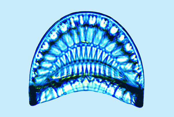 Campylodiscus thuretii