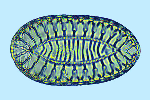 Surirella fastuosa